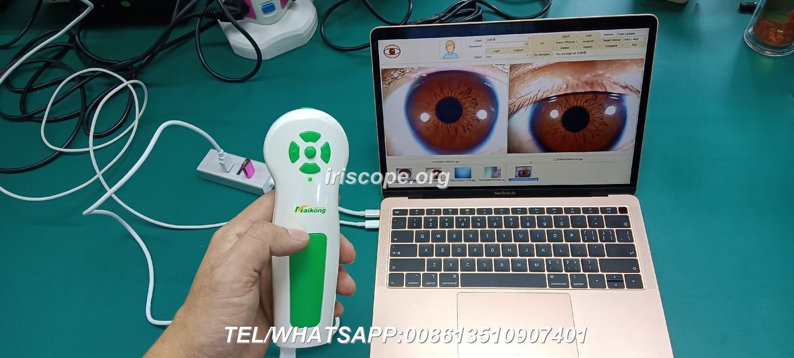 healthcare professional evaluating iridology camera options