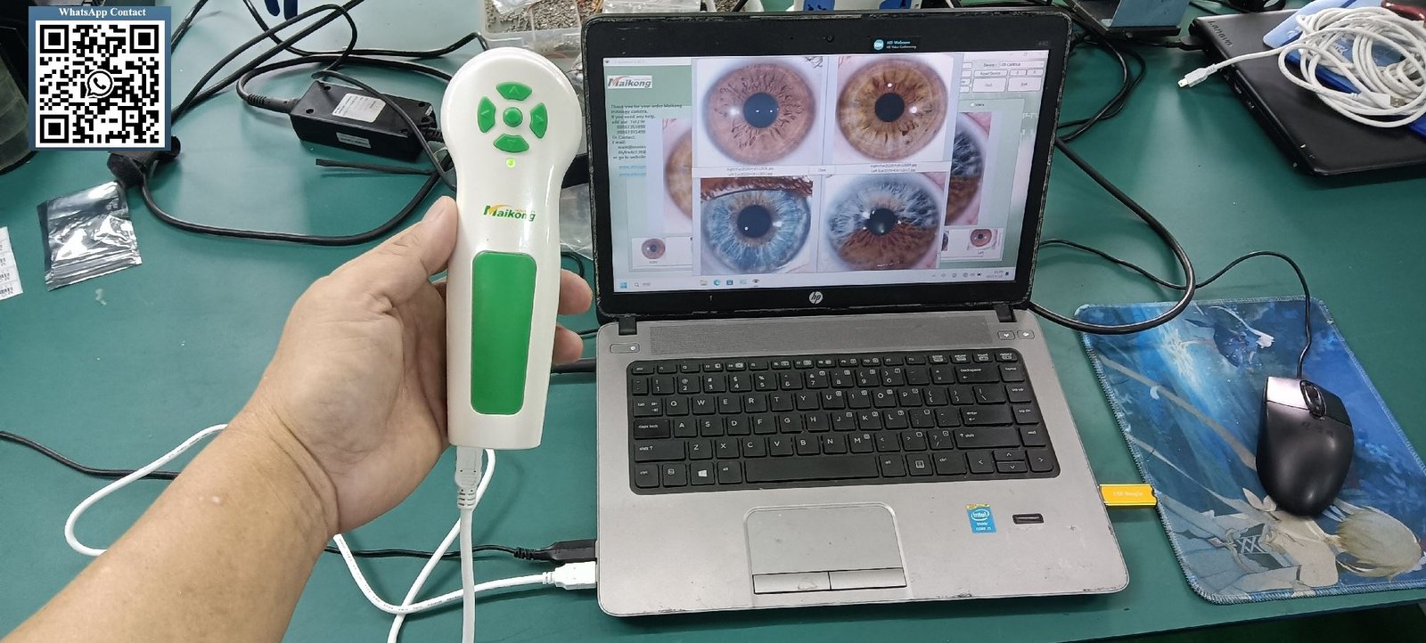 Professional iridology camera system showing USB iriscope device with software interface on computer screen