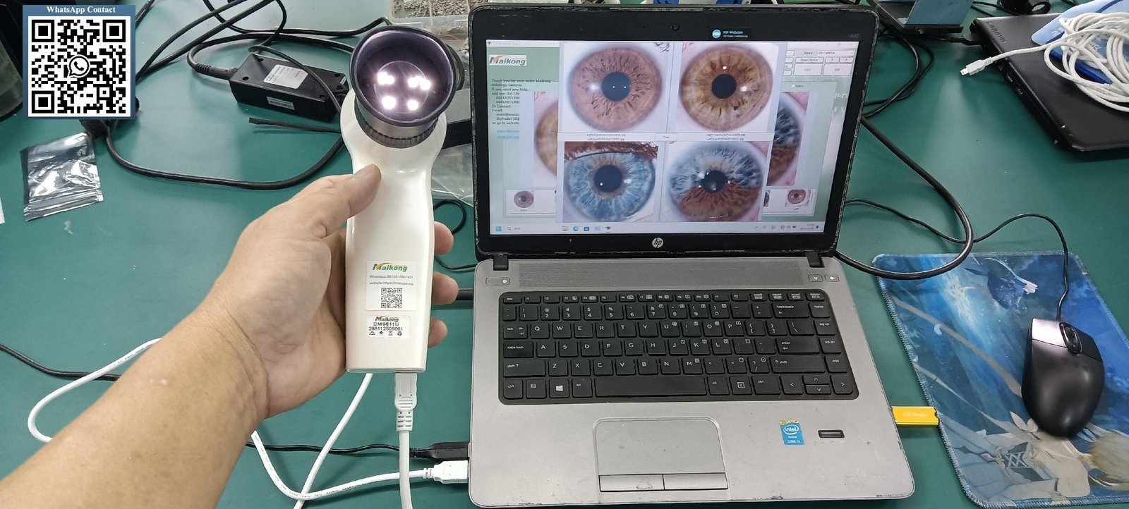 side by side comparison eyepix and MAIKONG iridology cameras