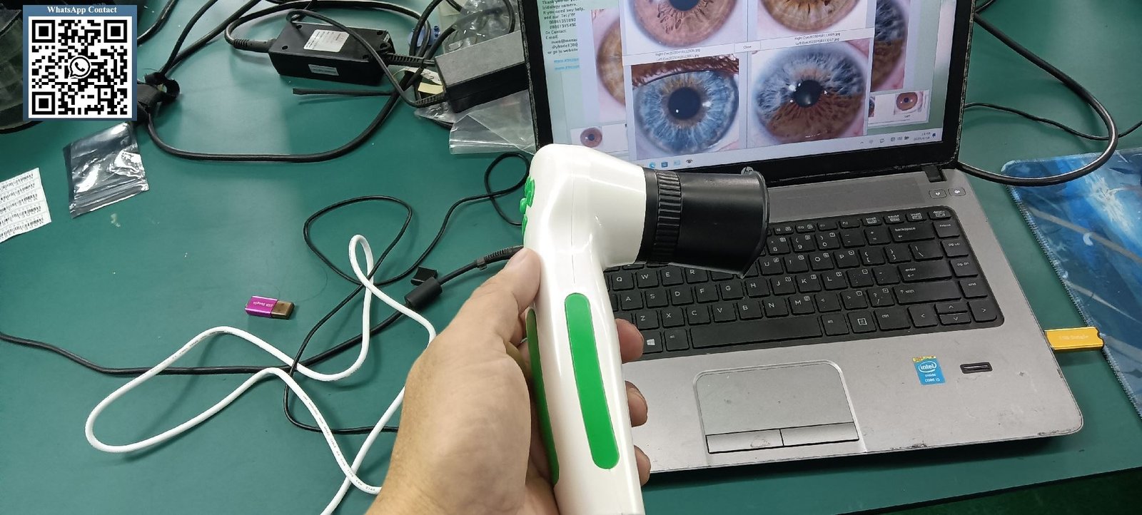 Complete iridology camera system with software interface displayed