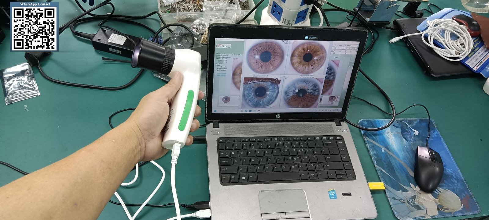 USB iridology camera connected to laptop