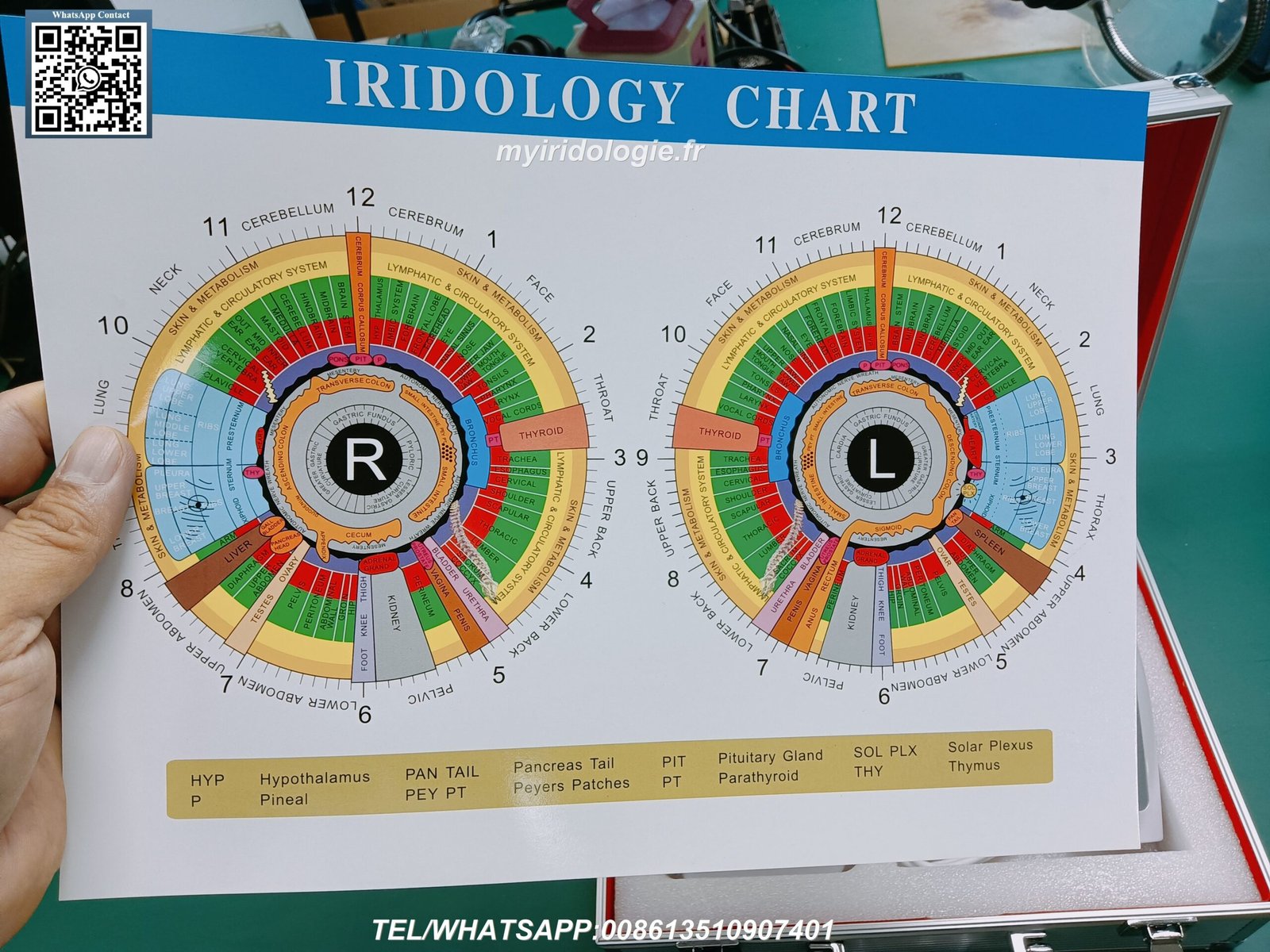 Material construction detail of medical-grade iridology stand components