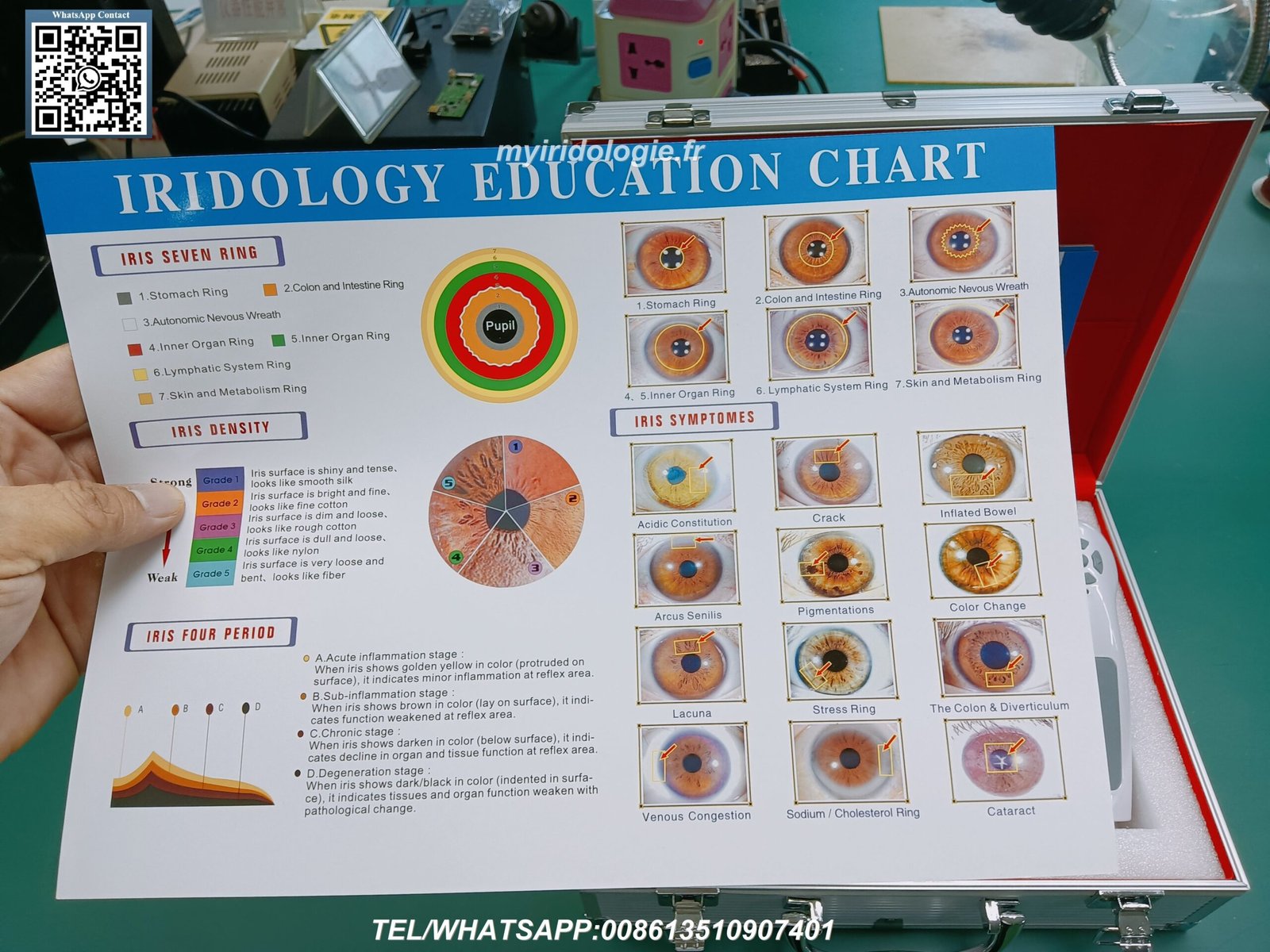 Material construction detail of medical-grade iridology stand components