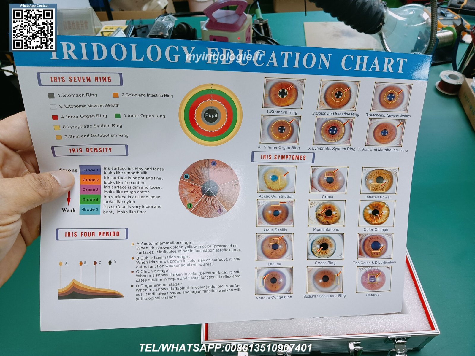 Comparison of different iriscope models
