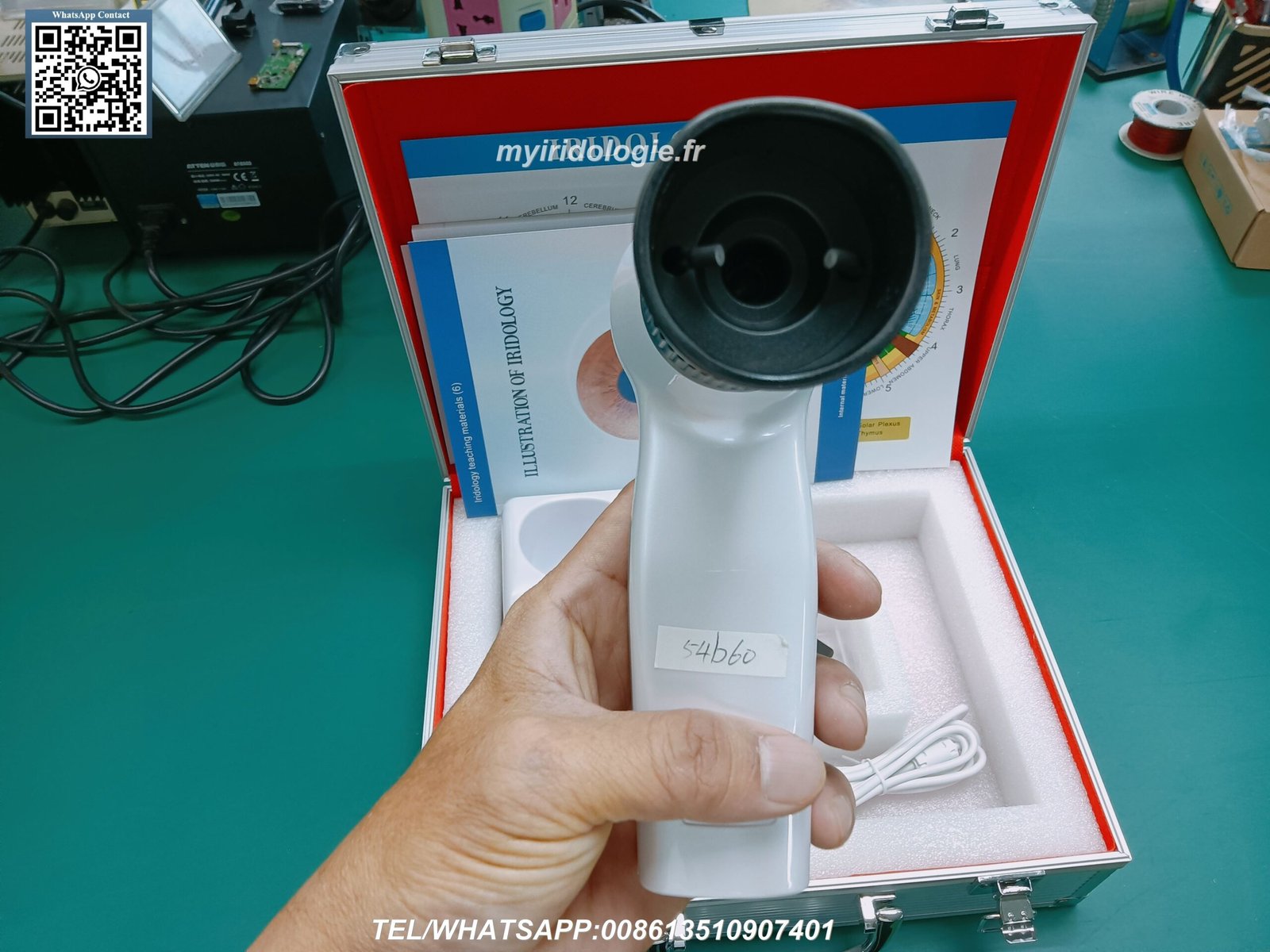 Digital iriscope analyzer displaying iris structure and patterns on computer screen