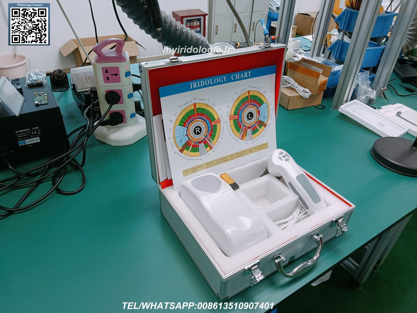 Digital iriscope analyzer displaying iris structure and patterns on computer screen