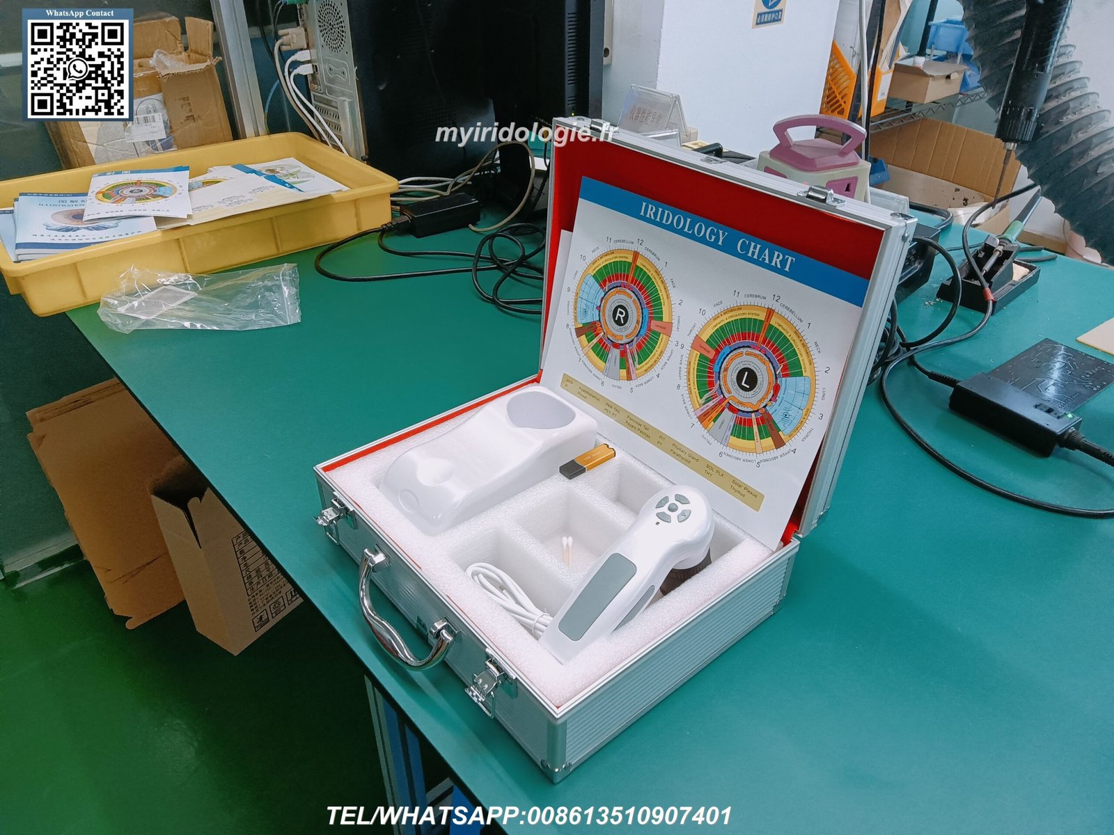 Digital iriscope analyzer displaying iris structure and patterns on computer screen
