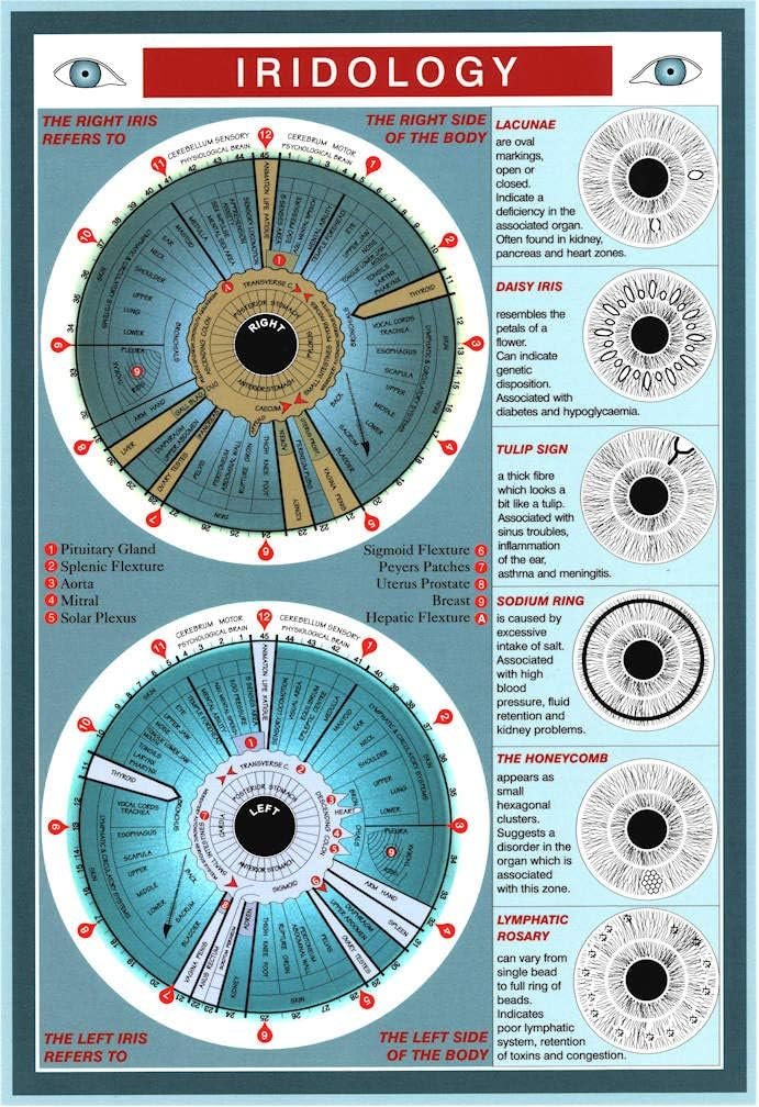 screenshot of digital iridology software showing chart overlay on iris image