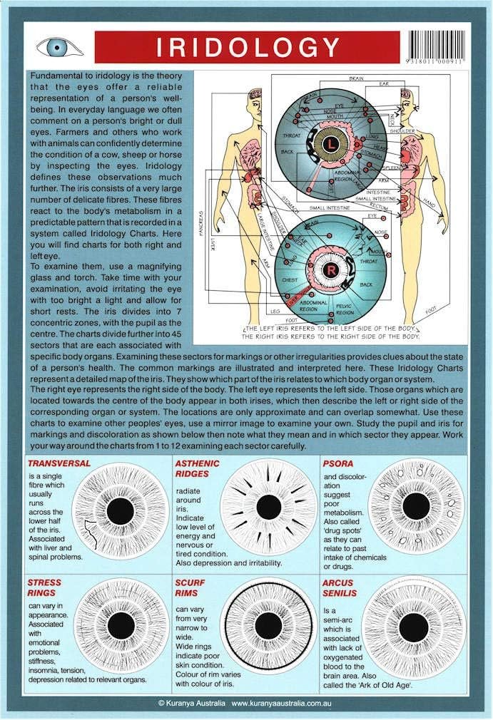 screenshot of digital iridology software showing chart overlay on iris image