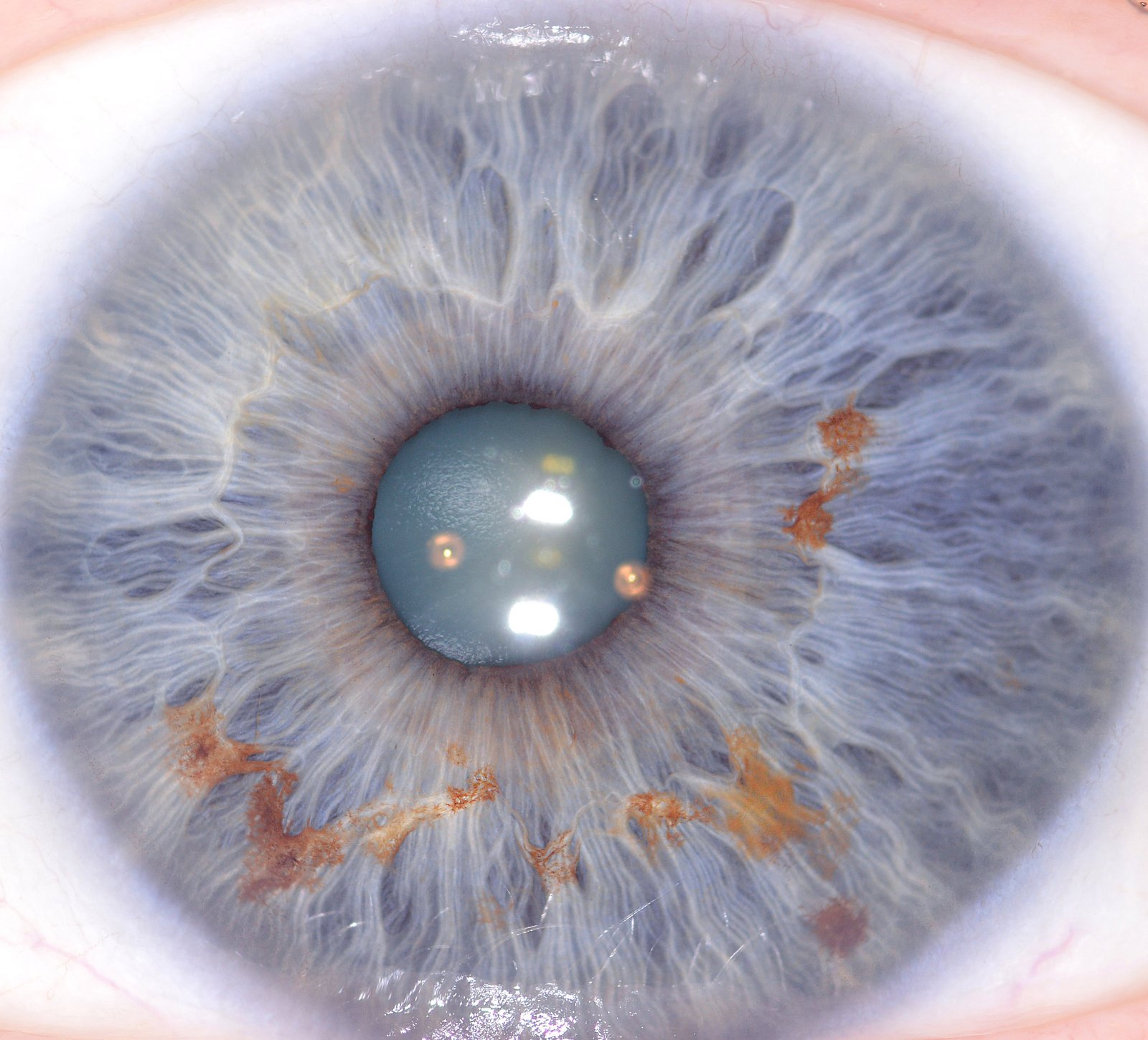 Iridologist Practical Guide for Certified Iridologists in Canada — 002 (5).jpg