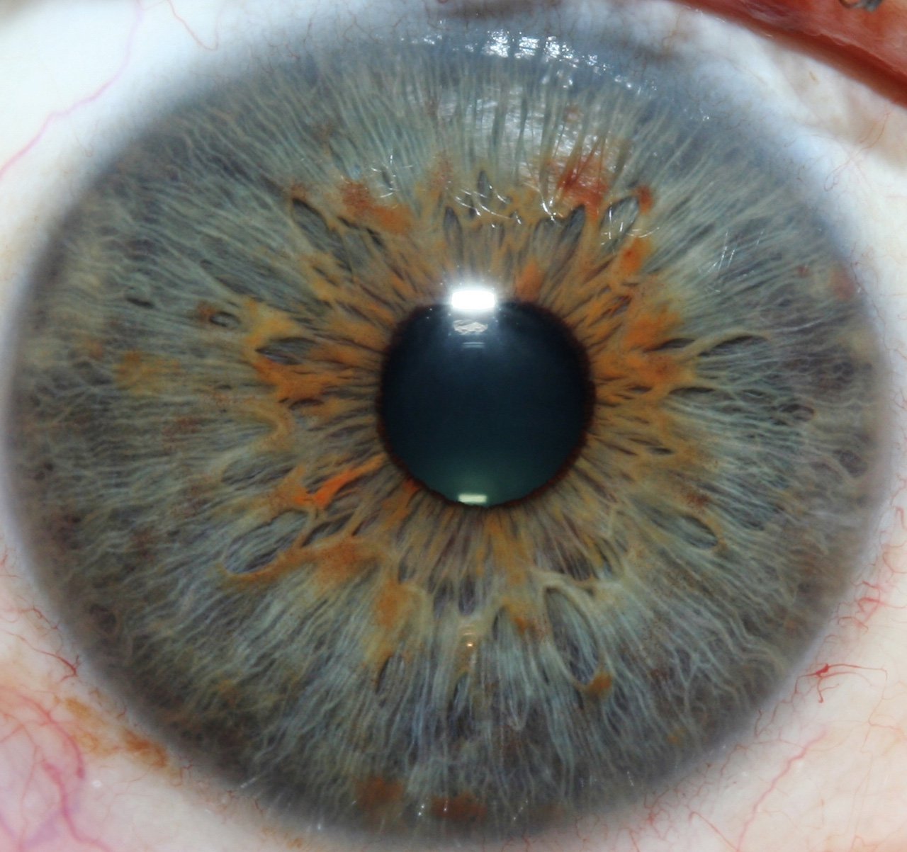 Clinic iris imaging workstation