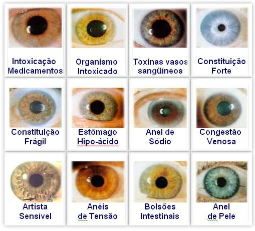 Free Iridology Chart: A Practical Guide for Iridology Schools in Canada 4 Free Iridology Chart: A Practical Guide for Iridology Schools in Canada — jensen iridology chart (5).jpg