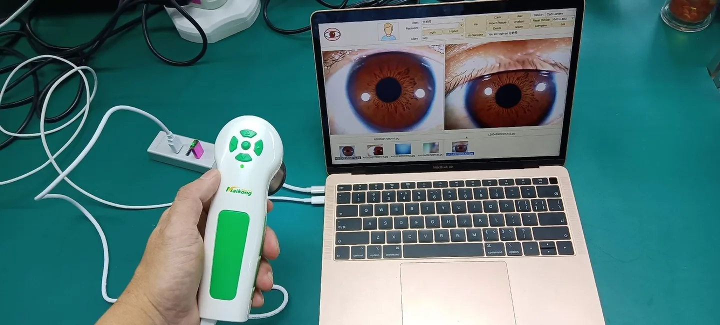 Standalone iriscope or integrated camera–software bundle: which is the better fit for Canadian iridology clinics? — appareil photo pour iridologie (40).JPG