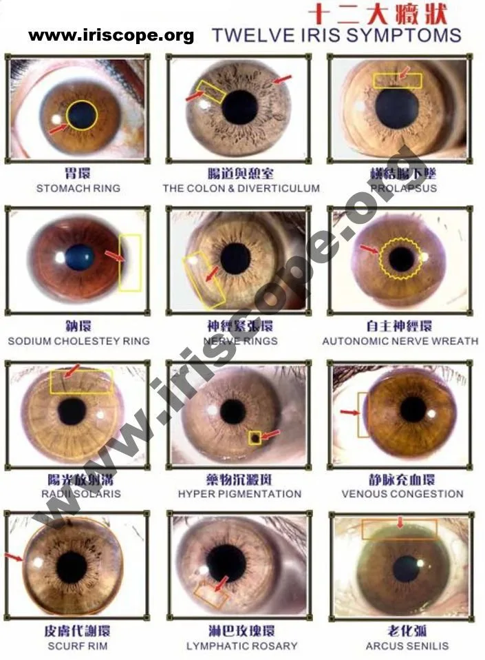Free Iridology Chart: A Practical Guide for Iridology Schools in Canada 5 Free Iridology Chart: A Practical Guide for Iridology Schools in Canada — jensen iridology chart (4).jpg