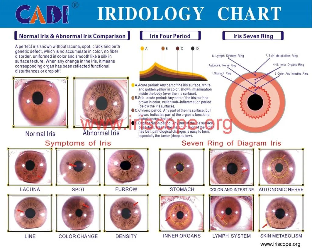 MAIKONG WIFI 20MP Iriscope camera MK 9888U 7 MAIKONG WIFI 20MP Iriscope camera MK 9888U — jensen iridology chart (3).JPG