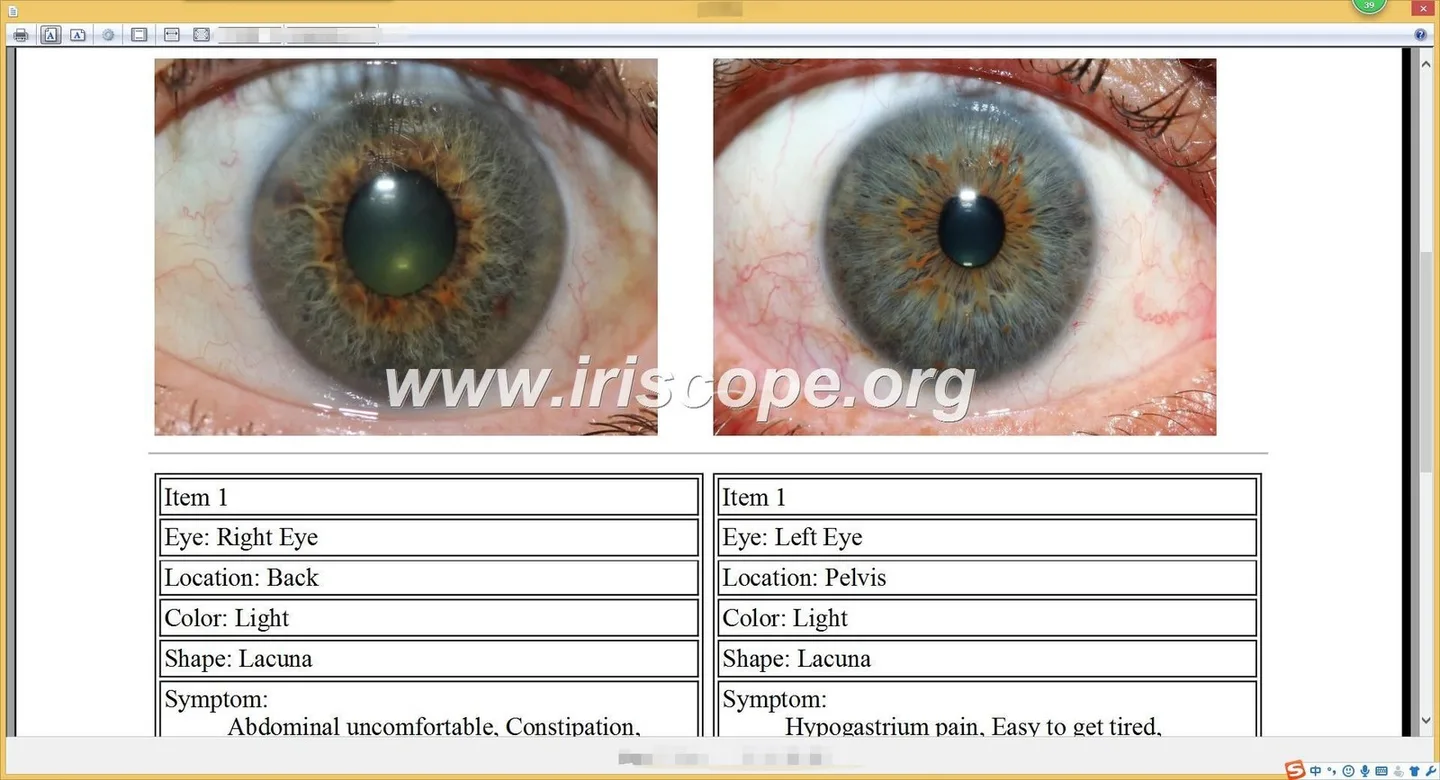 Localising multilingual iris imaging software for Canadian wellness clinics — Software de Iridología (53).JPG