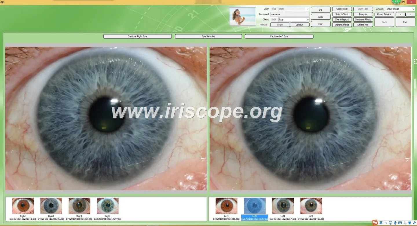 Localising multilingual iris imaging software for Canadian wellness clinics — Software de Iridología (30).JPG
