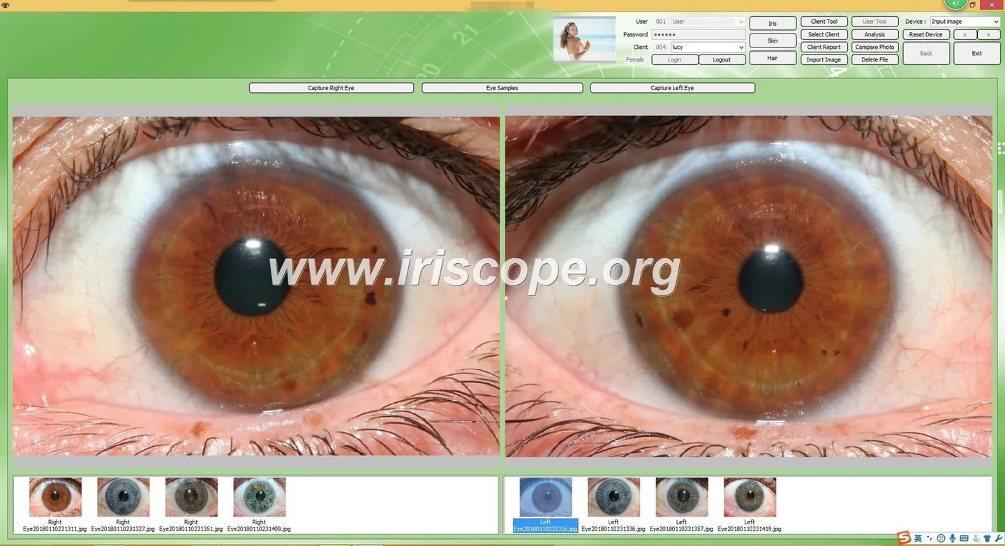 Localising multilingual iris imaging software for Canadian wellness clinics — Software de Iridología (29).JPG
