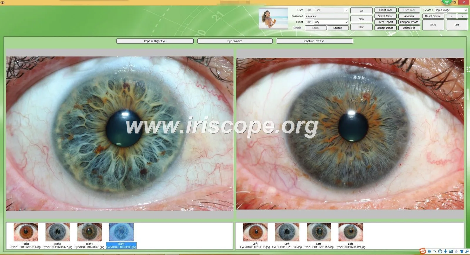 Localising multilingual iris imaging software for Canadian wellness clinics — Software de Iridología (31).JPG
