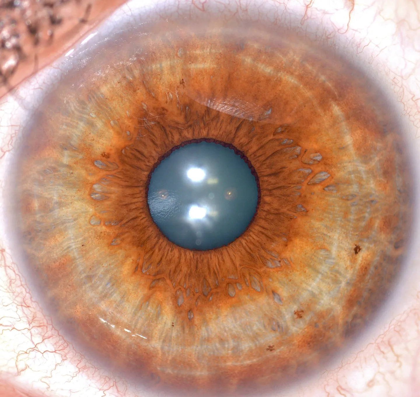Choosing lenses and macro options for detailed iris imaging in Canadian clinics — 002 (1).jpg
