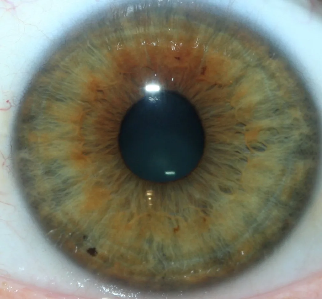 Expanded Vision for Iridology Schools in Canada: a practical, classroom‑first guide — 005-1.jpg