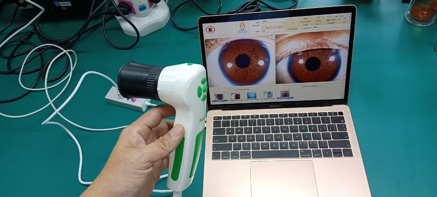 First‑Run OEM Sample QA Checklist for Iridology Cameras and Iriscope Pilot Lots (Canada) — appareil photo pour iridologie (42).JPG