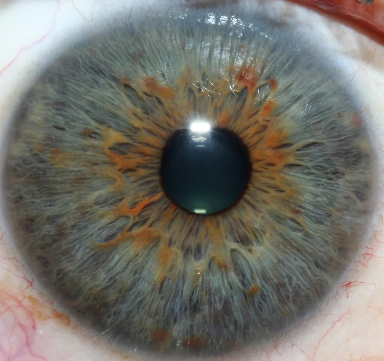 Standalone iriscope or integrated camera–software bundle: which is the better fit for Canadian iridology clinics? — Scientist-examining-iris-photographs-in-a-research-laboratory-setting-1024x683.jpeg