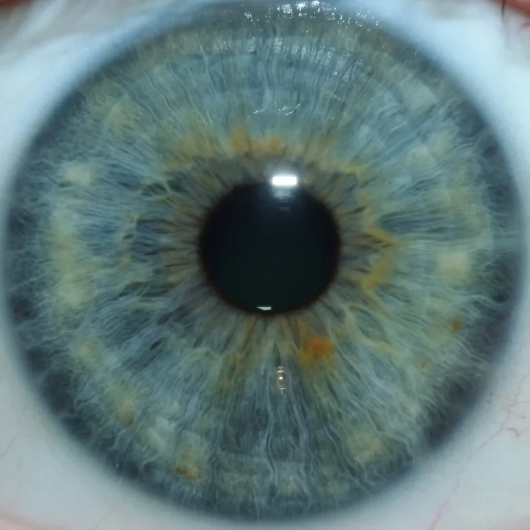Controlling lighting and reflections for sharp iris photography in Canadian clinics — Global-map-showing-Maikong-iriscope-distribution-network-1024x585.jpeg
