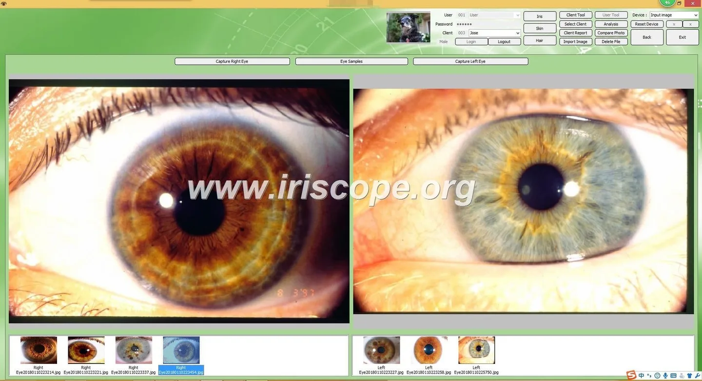 USB vs networked iris camera interfaces: a practical guide for Canadian naturopathic and iridology clinics — Software de Iridología (14).JPG