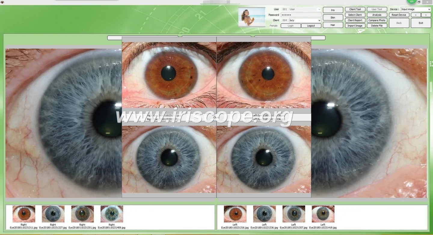 USB vs networked iris camera interfaces: a practical guide for Canadian naturopathic and iridology clinics — Software de Iridología (32).JPG