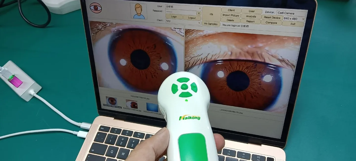 USB vs networked iris camera interfaces: a practical guide for Canadian naturopathic and iridology clinics — appareil photo pour iridologie (16).JPG