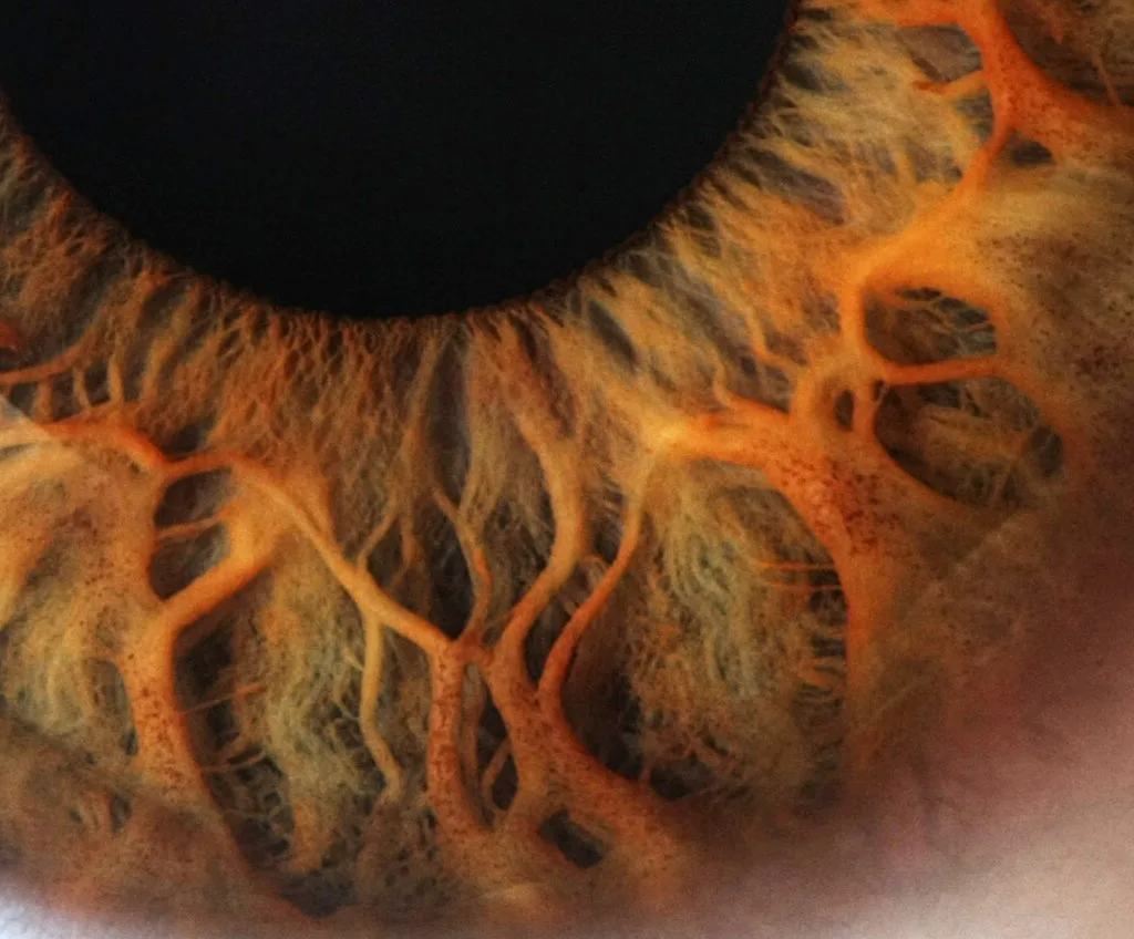 USB vs networked iris camera interfaces: a practical guide for Canadian naturopathic and iridology clinics — Iridología (4).jpg