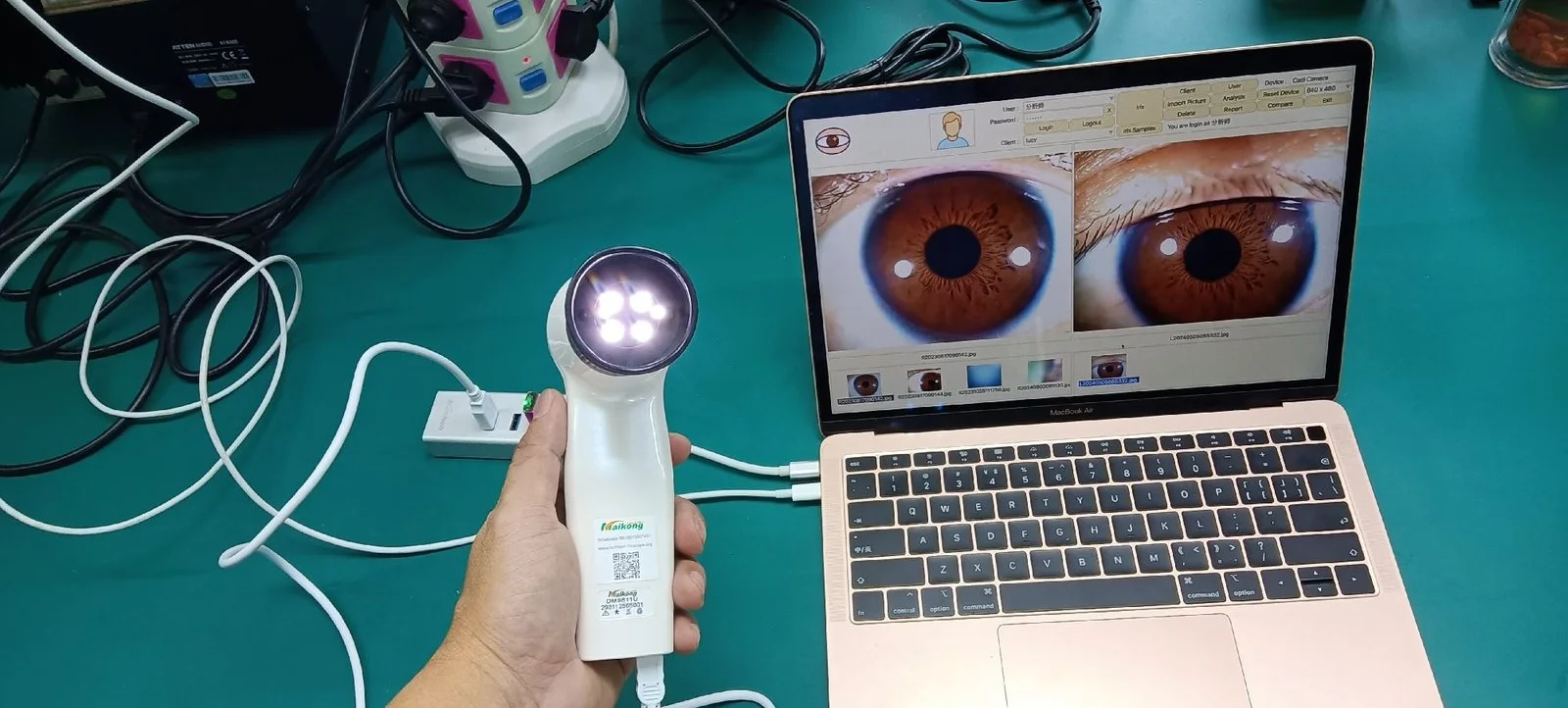 What Canadian holistic clinics should know when choosing an iriscope — appareil photo pour iridologie (38).JPG